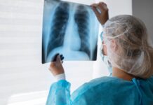 Suman más de 5 mil casos de tuberculosis en lo que va de 2024