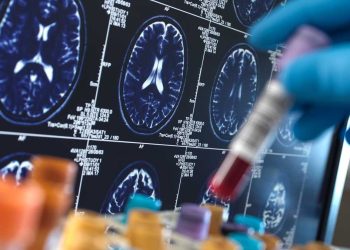 DESCUBREN LA PRIMERA TRANSMISIÓN ACCIDENTAL DEL ALZHÉIMER