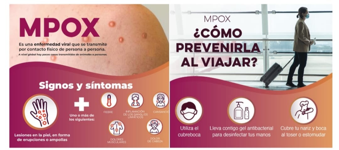 Salud Sonora atiende recomendaciones preventivas ante riesgos internacionales por Viruela del Mono (MPOX)