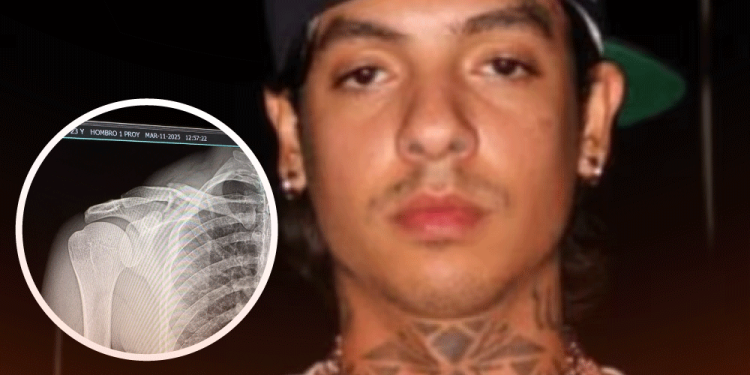 Natanael Cano sufre fractura de clavícula en accidente de motocross