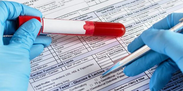 Un análisis de sangre podría detectar 50 tipos de cáncer antes de que aparezcan los síntomas