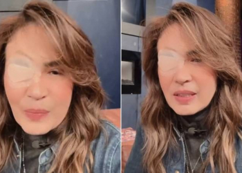 Yolanda Andrade regresa al trabajo con el ojo parchado y genera reacciones encontradas