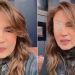 Yolanda Andrade regresa al trabajo con el ojo parchado y genera reacciones encontradas