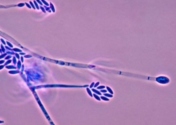 ¿QUÉ ES EL HONGO FUSARIUM SOLANI? MÉXICO CUENTA 24 CASOS Y UNA MUERTE POR ESTA INFECCIÓN