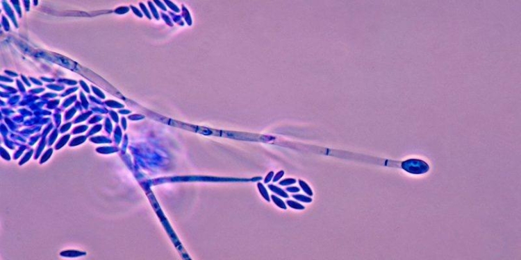 ¿QUÉ ES EL HONGO FUSARIUM SOLANI? MÉXICO CUENTA 24 CASOS Y UNA MUERTE POR ESTA INFECCIÓN