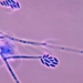 ¿QUÉ ES EL HONGO FUSARIUM SOLANI? MÉXICO CUENTA 24 CASOS Y UNA MUERTE POR ESTA INFECCIÓN