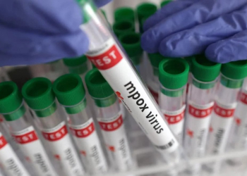 CONFIRMAN DOS CASOS DE ( MPOX ) ‘VIRUELA DEL MONO’ EN SONORA