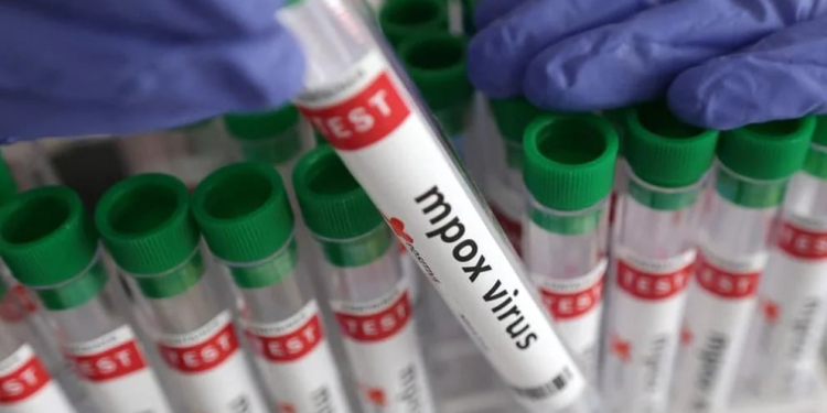 CONFIRMAN DOS CASOS DE ( MPOX ) ‘VIRUELA DEL MONO’ EN SONORA