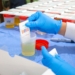 APLICAN EXÁMENES TOXICOLÓGICOS A PERSONAL OPERATIVO DE SEGURIDAD PÚBLICA DE CAJEME