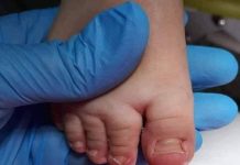 No se deben utilizar zapatos en bebés, ellos no caminan y los primeros meses son innecesarios.
